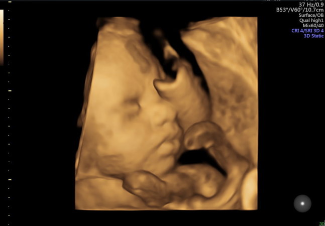 Treće tromjesječje - uskoro ćete upoznati svoju bebu!